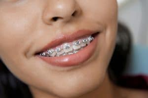 Marketing for Orthodontists